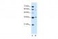 PARL antibody - N-terminal region